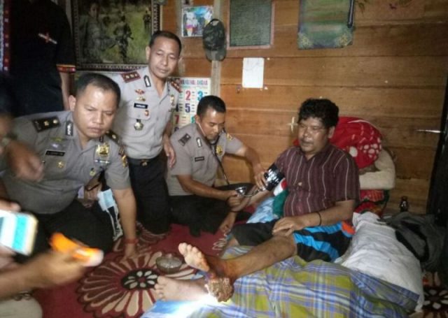 kapolres aceh tengah Kapolres Aceh Tengah, AKBP Hairajadi, SH, bersama tim dokkes Polda Aceh menjenguk Armadri, penderita tumor, Kamis (12/4/2018). (Foto/Bahtiar Gayo)
